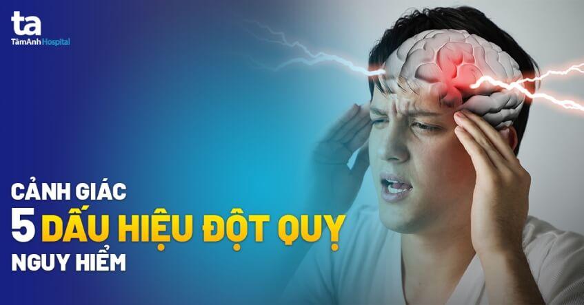 5 dấu hiệu đột quỵ nguy hiểm cần lưu ý và xử trí ngay