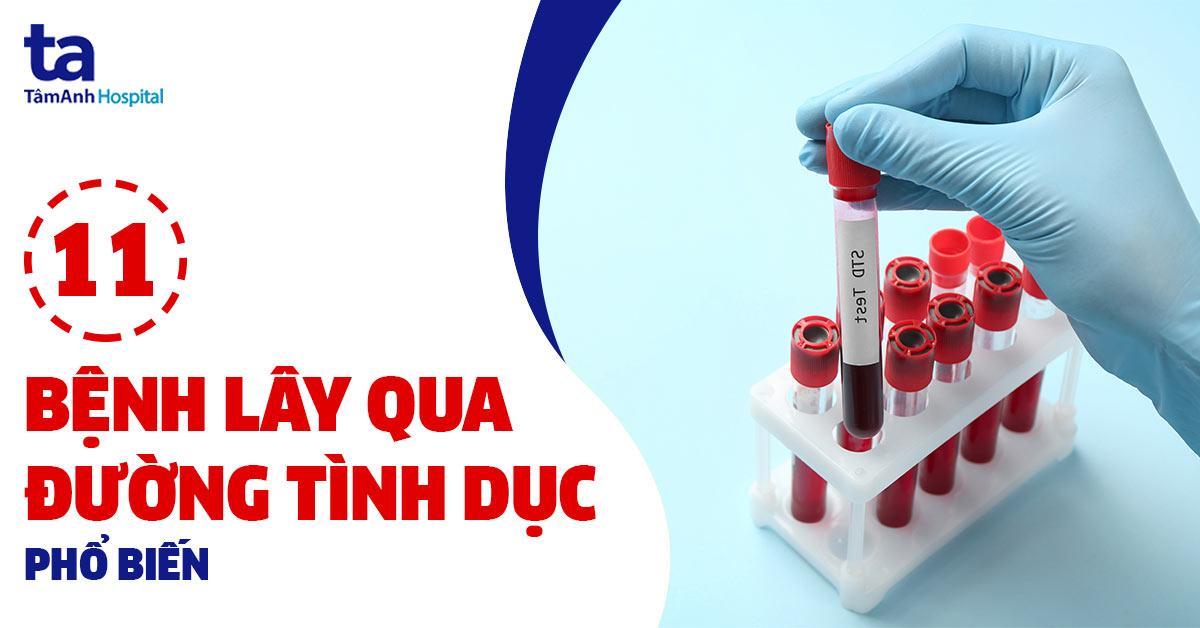 bệnh lây qua đường tình dục