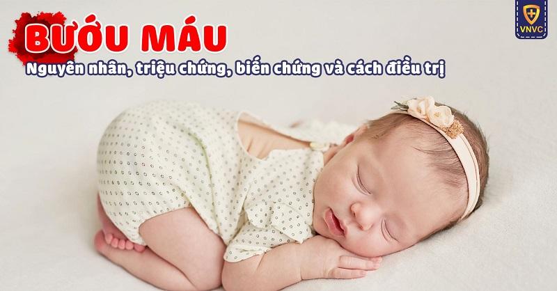 Bướu máu: Nguyên nhân, triệu chứng, biến chứng và cách điều trị