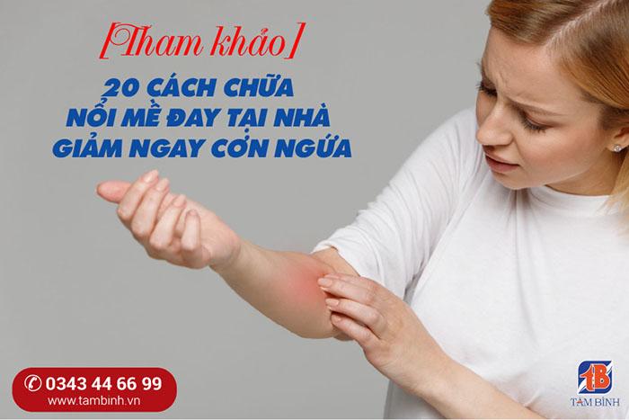 [TOP 20+] cách trị nổi mề đay tại nhà hiệu quả: chữa đâu hết đấy