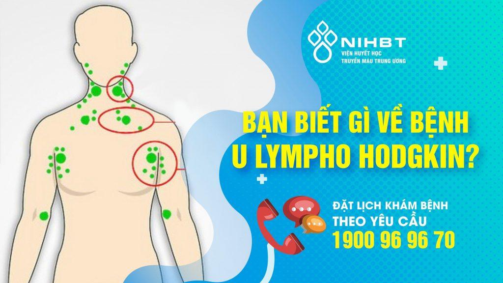 Bệnh U lympho Hodgkin là gì? Tiên lượng điều trị như thế nào?