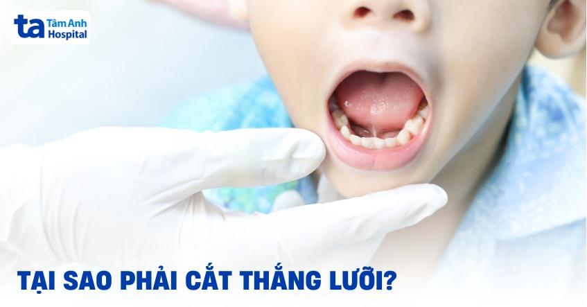 cắt thắng lưỡi