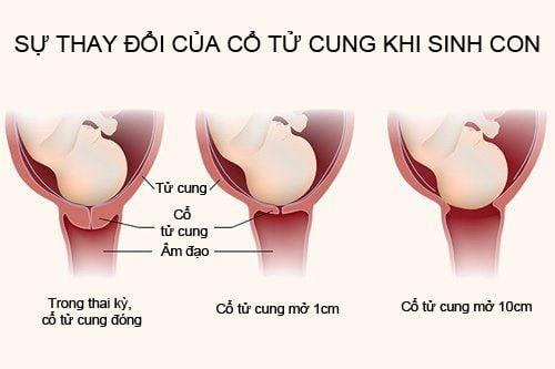 Dấu hiệu sắp sinh con rạ