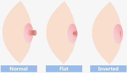 Loại núm vú của bạn là gì? 24 sự thật khác về núm vú