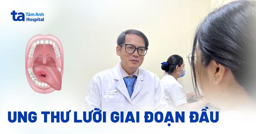 Ung thư lưỡi giai đoạn đầu có chữa được không? Dấu hiệu sớm