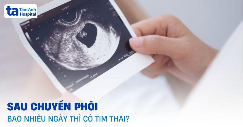 Sau chuyển phôi bao nhiêu ngày thì có tim thai?