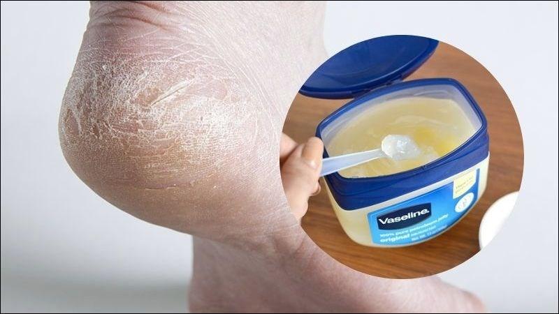 5 cách trị nứt gót chân bằng vaseline tại nhà đơn giản và hiệu quả