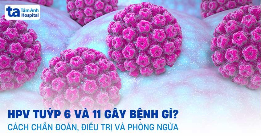 hpv tuýp 6 và 11